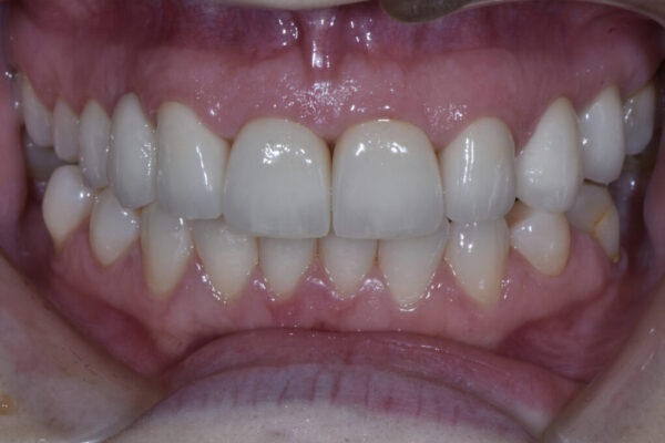 After